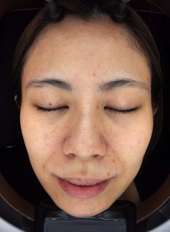 スタッフHの10日間後の変化1