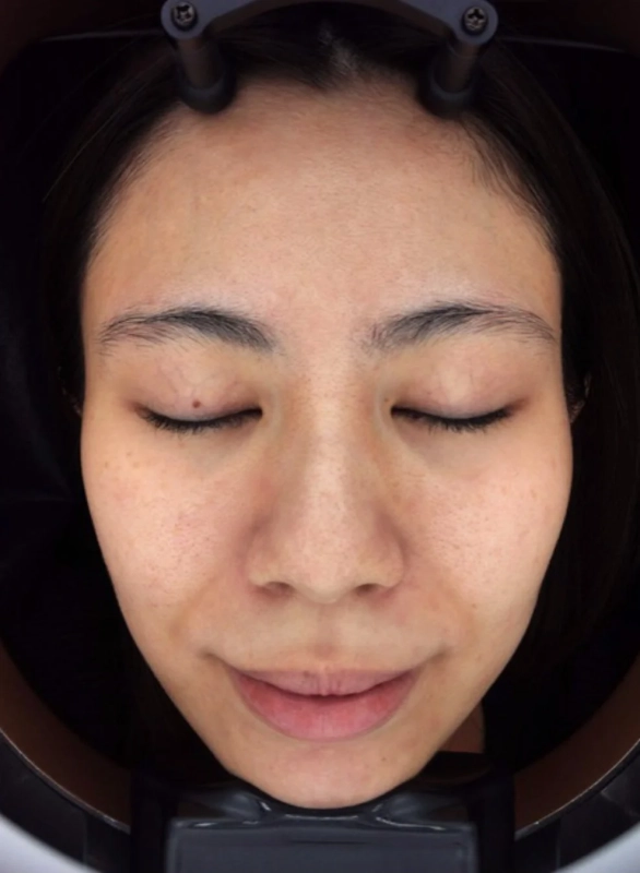 スタッフHの10日間後の変化2