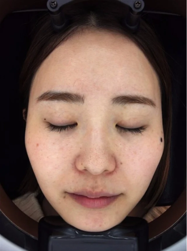 スタッフKの10日間後の変化1