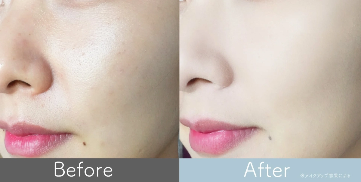 メイクアップ効果によるビフォーアフター