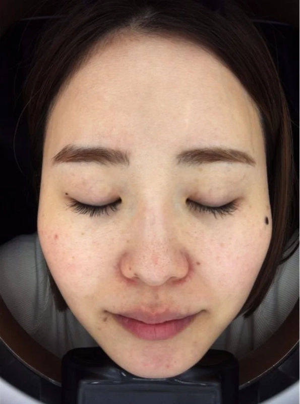 スタッフKの10日間後の変化2