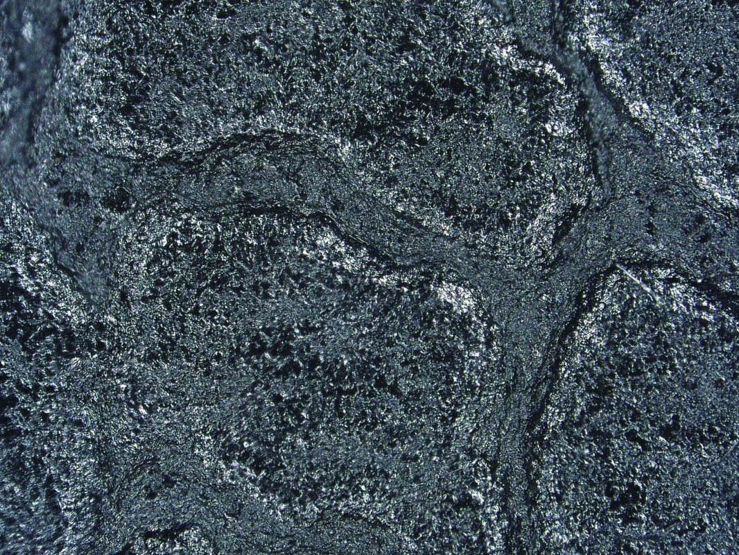 花粉のイメージ