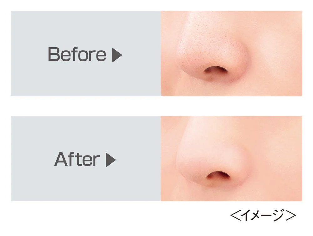 鼻の毛穴のビフォーアフター