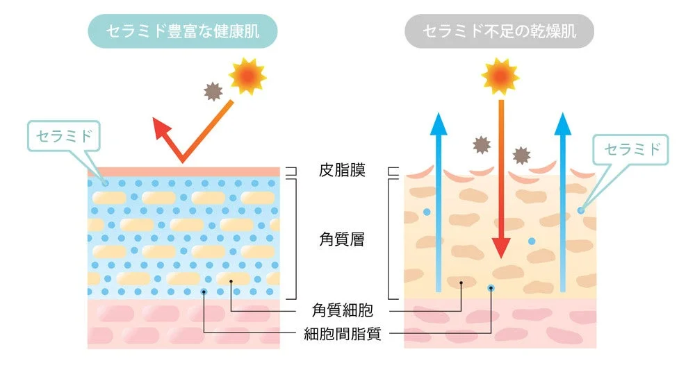 セラミド豊富な健康肌とセラミド不足の乾燥肌