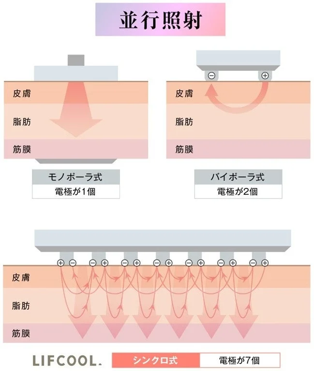この画像は、モノポーラ式、バイポーラ式、シンクロ式の3種類の並行照射技術における電極の数とエネルギーの浸透範囲を、皮膚、脂肪、筋膜の層に対して比較した図です。特にLIFCOOLのシンクロ式では7個の電極が示されています。