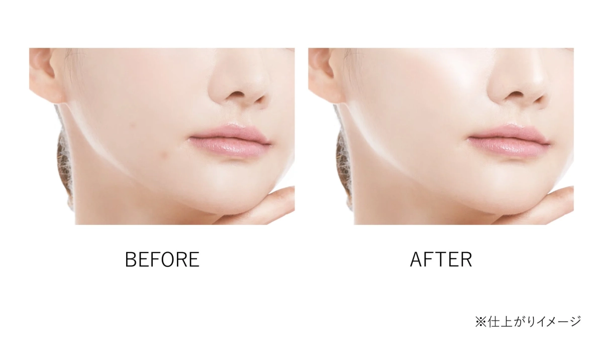 ビフォーアフターイメージ