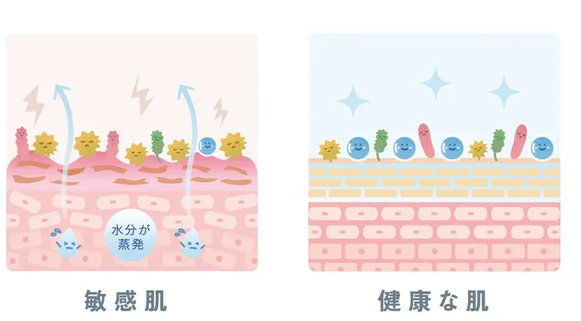 健康肌と敏感肌の肌状態比較