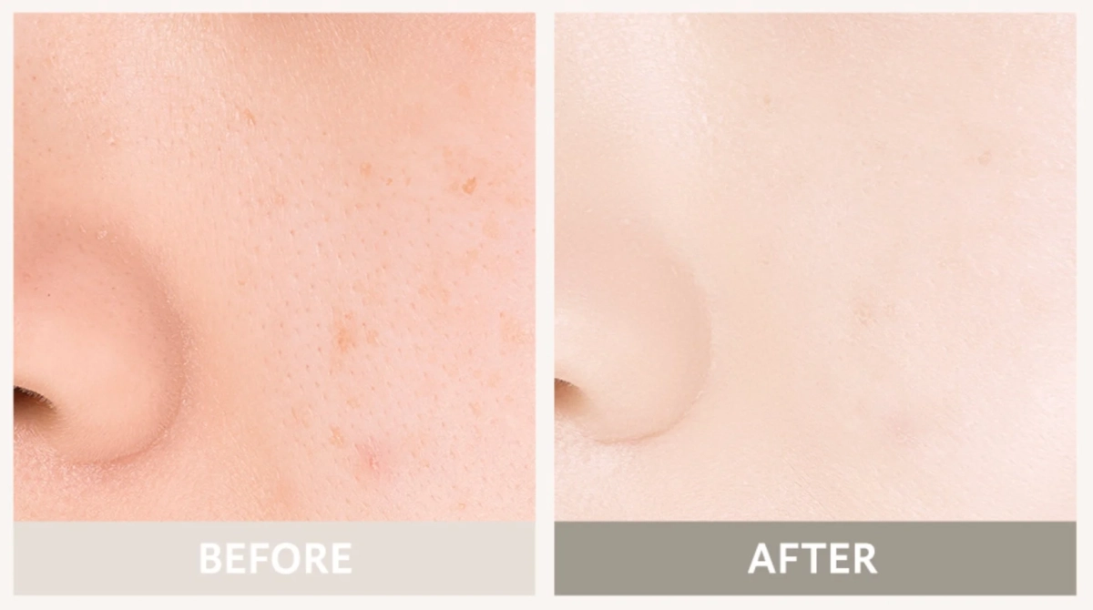 肌のビフォーアフターを比較した画像