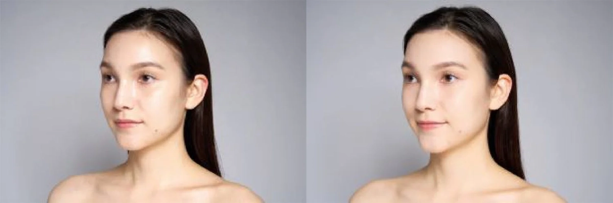 ツヤ肌イメージ