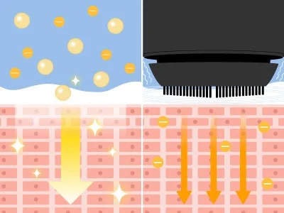 イオン導入イメージ