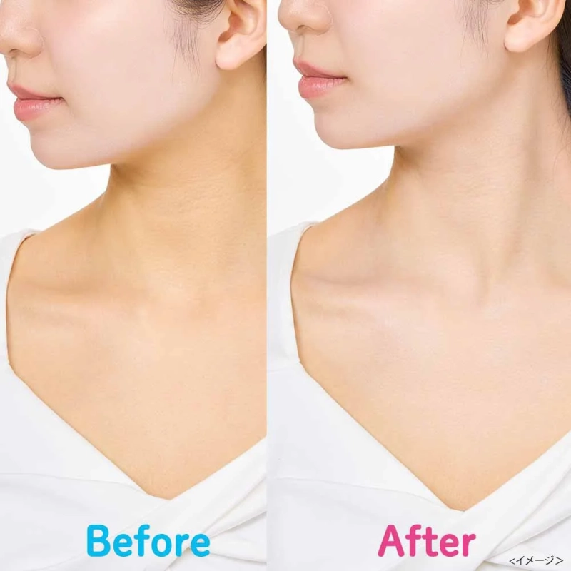 首からデコルテにかけてのビフォーアフター画像