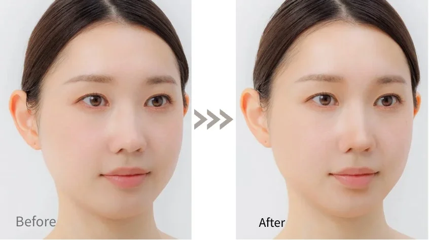 シェーディング ビフォーアフター