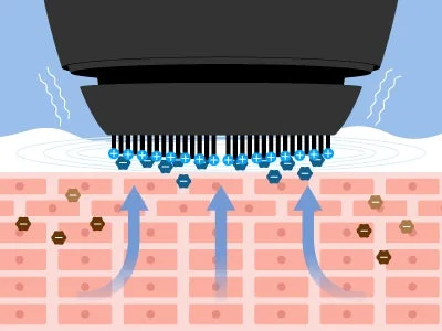 イオン導出イメージ