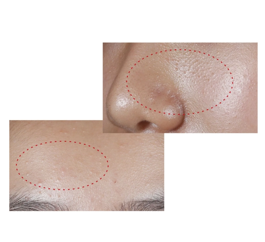 毛山イメージ画像