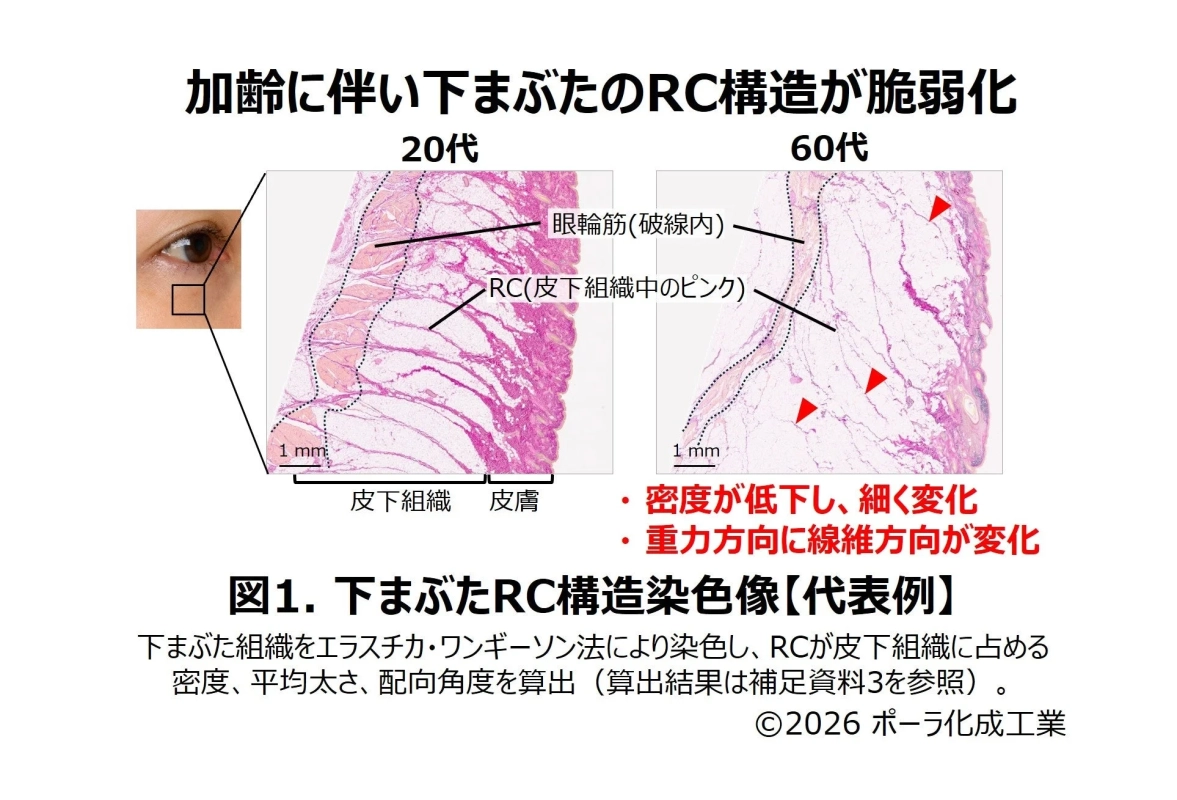 下まぶたRC構造染色像