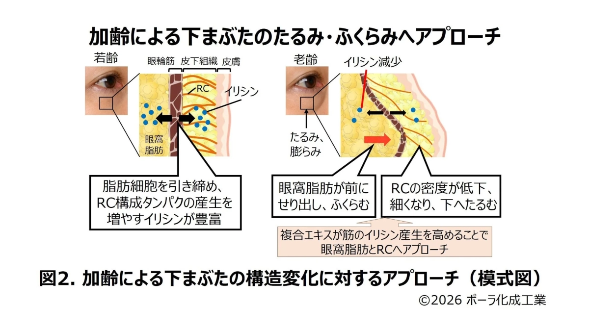 加齢による下まぶたの構造変化に対するアプローチ