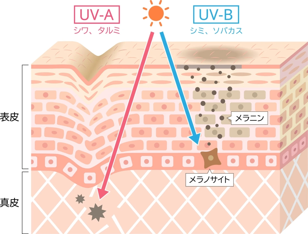 紫外線が肌に与える影響